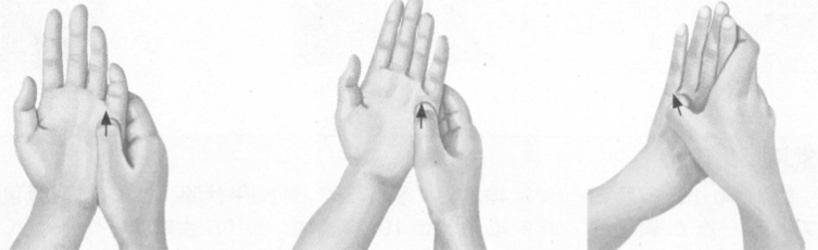 阳痿